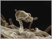 Nanobes
