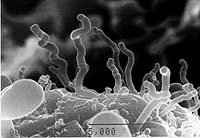 Nanobes